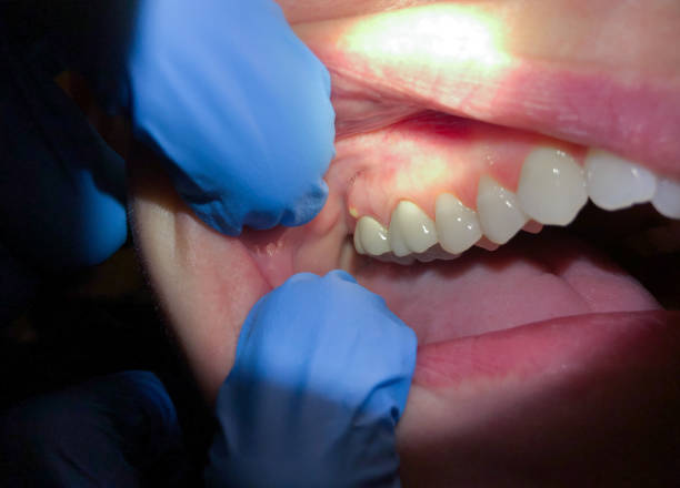 Best Cosmetic Emergency Dentistry in Kennett, MO