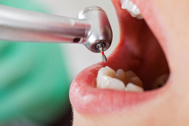 Best Emergency Dental Care for Broken or Chipped Teeth in Kennett, MO